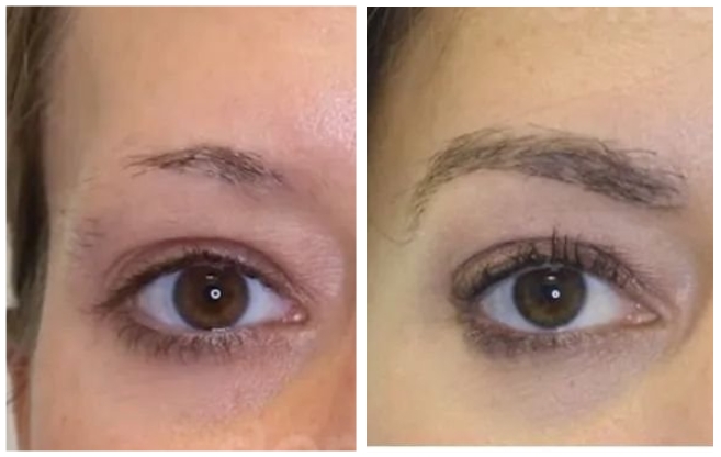 Femra mbjellje floku Alma