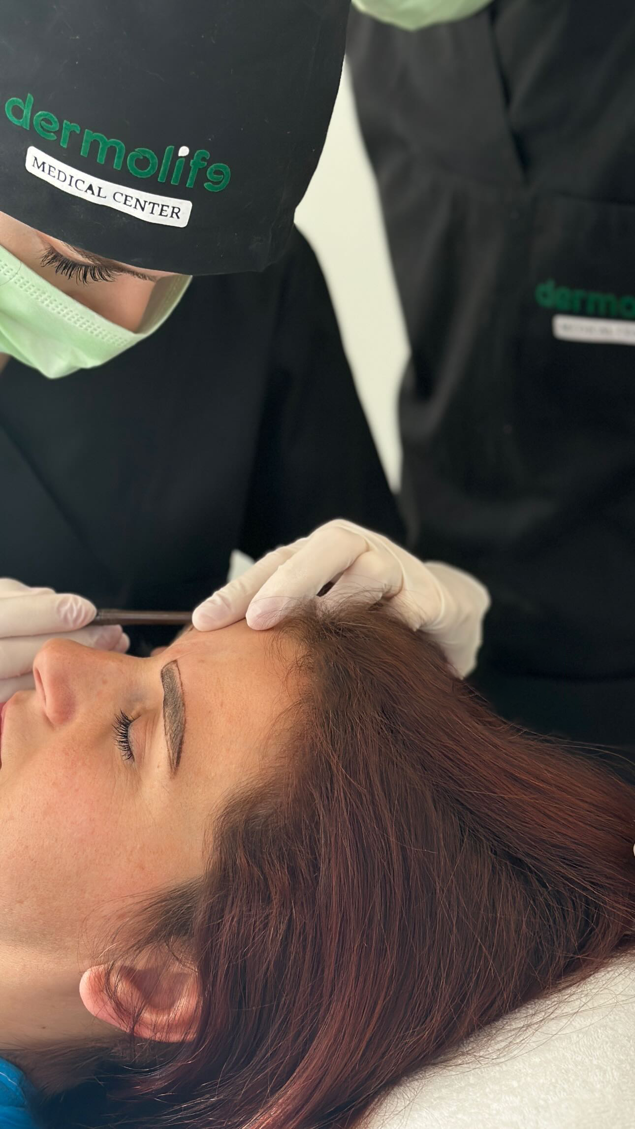 Transplanti i vetullave për femra